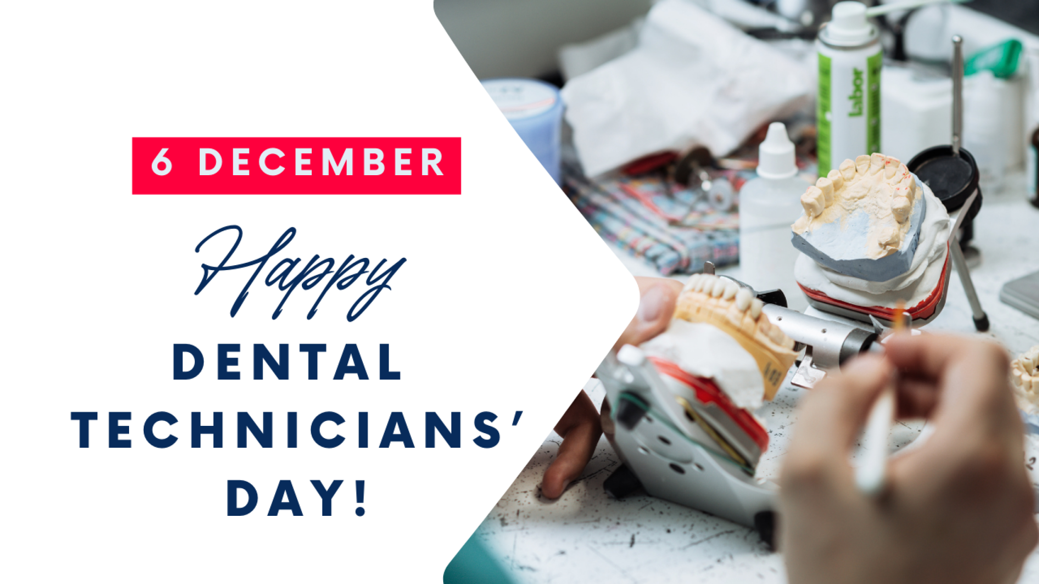 Happy Dental Technicians Day – December 6th! 🦷