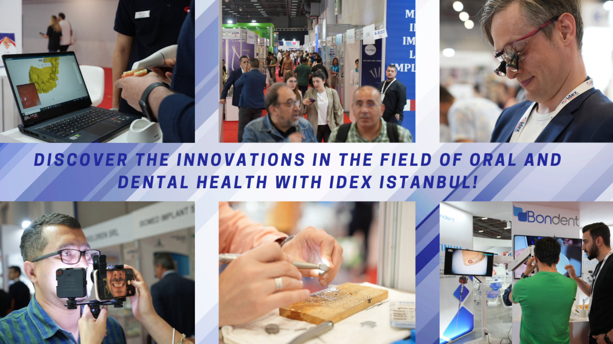 Discover the innovations in the field of Oral and Dental Health with IDEX Istanbul!