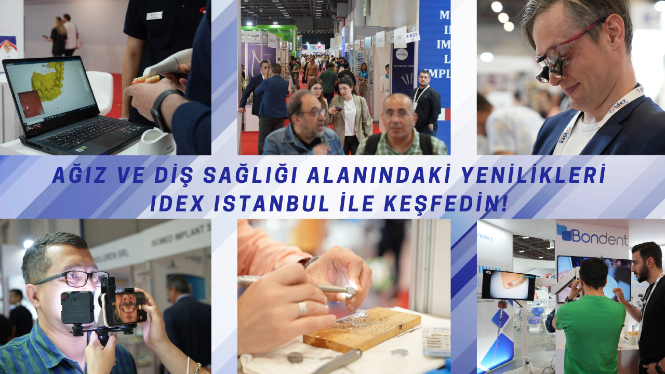 Ağız ve Diş Sağlığı alanındaki yenilikleri IDEX Istanbul ile keşfedin!